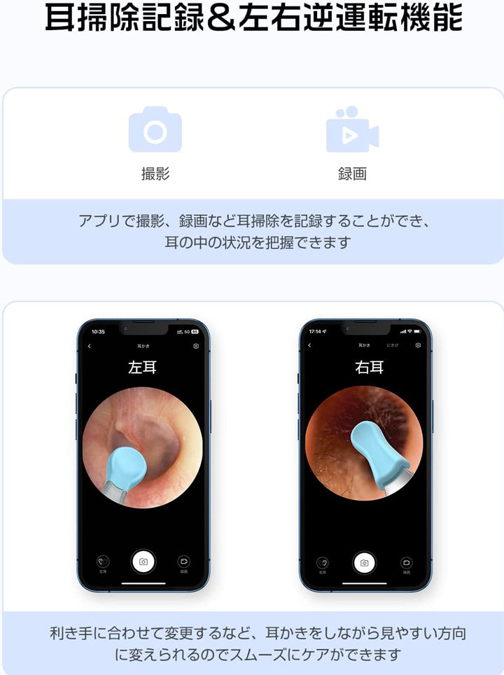 耳かき カメラ LEDライト WIFI ワイヤレス付き iPhone 耳かきスコープ 内視鏡付き 耳掃除 口腔ケア 耳 鼻 可視化 耳鏡 Android XLIFE-X3 正規品 無線 子供 ペット犬 猫 にも使用可能 WIFI接続